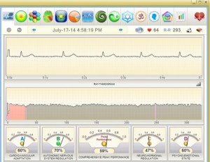 Morley-ECG-HRV-screen-july-2014-3-768x595