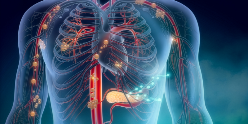 Lymphatic-Therapies.webp Microcurrent Therapy Edmonton